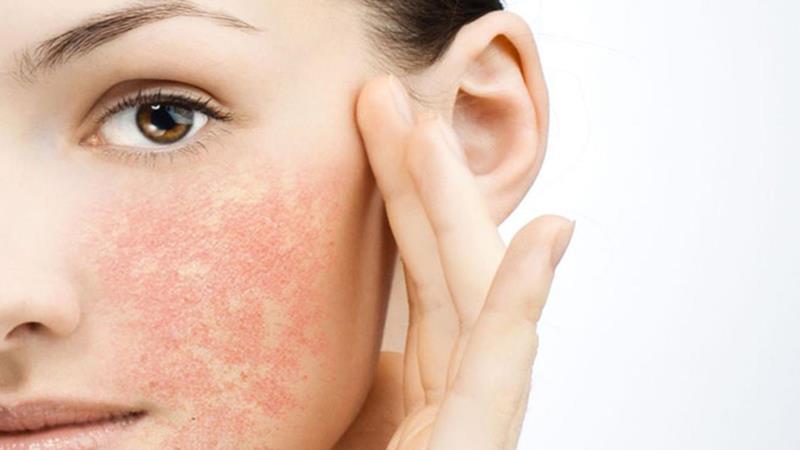 Phục hồi da bệnh lý